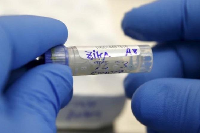 Sampel darah dengan virus Zika (Foto: AFP)