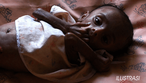 LSM: Pemkab Tambrauw Lamban Tangani Kelaparan & Gizi Buruk