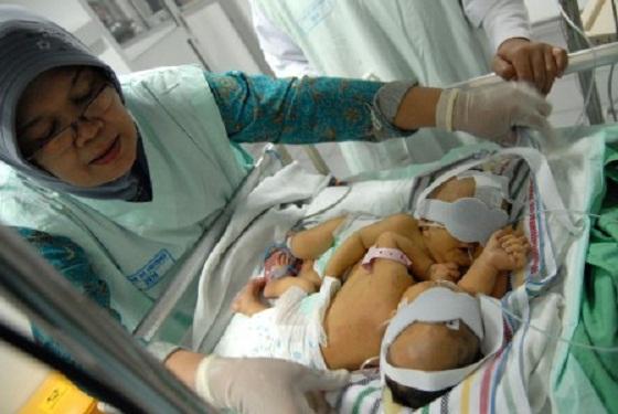 Tekan Jumlah Bayi Prematur, Ini Langkah Kemenkes 