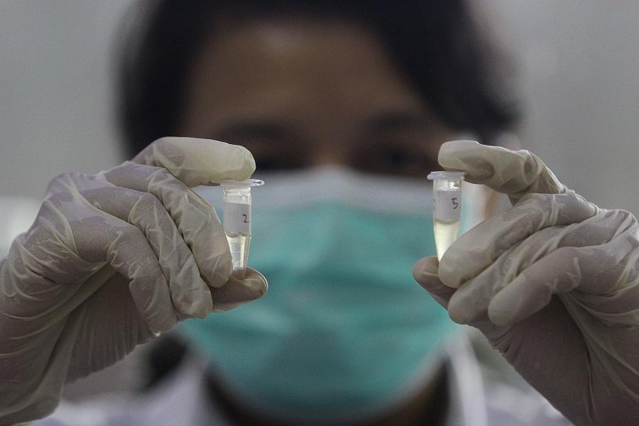 Indonesia Bantah Tudingan Tak Becus Deteksi Virus Corona