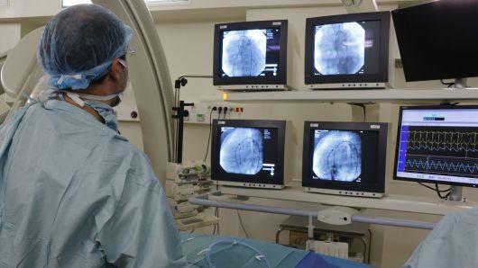 Metode Baru Memprediksi Serangan Jantung Berbekal CT Scan